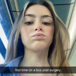 Julia Carlile Instagram - 1 year post op. Then > current day in chronological order. Swipe to the end to see my progress🙌🏻