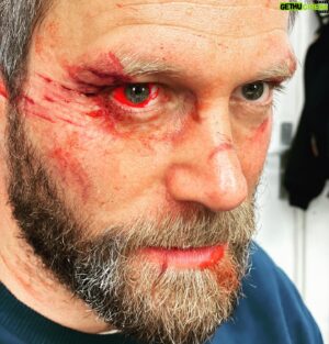 Ken Duken Instagram - #aboutthisyear lots of #fakewounds and #realbruises something #crazy #coming #nextyear @skydeutschland #skyseries #behindthescenes #makeup by @georgkfx @ameliehartwig #illkeepyouposted 🤙🔥❤️