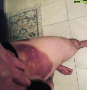 Ken Duken Instagram - #aboutthisyear lots of #fakewounds and #realbruises something #crazy #coming #nextyear @skydeutschland #skyseries #behindthescenes #makeup by @georgkfx @ameliehartwig #illkeepyouposted 🤙🔥❤️