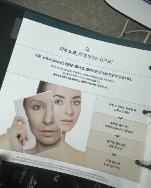 Kim Eun-young Instagram - 연예인 피부 관리 뭐 별거 없어요~
그냥 보시다시피 좋은 시술 이렇게 다 때려박으면 되는걸요~^^
시술이 궁금하시면 게시물을 옆으로 넘겨주세요!

요즘 이영애 리프팅으로 유명하다는 덴서티 하이
설명은 듣긴 했는데 용어가 어려우니
그냥 사진보는게 빠를거에요 ㅎㅎㅎㄹ
우선 제 솔직한 후기는 
받은 직후에 붉은 기나 붓기 전혀 없었고
아플까봐 살짝 쫄았는데!!!
일단 안아파서 넘 좋아요ㅋㅋㅋㅋ
살짝 뜨겁긴한데 참을만해요 ㅎㅎ 
예뻐질려면 뭐 이정도쯤은~^^

받고나서 피부가 쫀쫀해지고 탱탱해져서
기분이 좋아욯ㅎㅎㅎ아 의사선생님께서
콜라겐 엘라스틴 촉진시켜주는거라 볼륨이 생기는거래요!
여러분도 저랑 같이 아름다워져요!🩵
@density.kr 

#density #덴서티리프팅 #리프팅후기 
#학동사거리피부과 #방숙현원장님