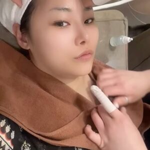 Kim Eun-young Instagram - 연예인 피부 관리 뭐 별거 없어요~
그냥 보시다시피 좋은 시술 이렇게 다 때려박으면 되는걸요~^^
시술이 궁금하시면 게시물을 옆으로 넘겨주세요!

요즘 이영애 리프팅으로 유명하다는 덴서티 하이
설명은 듣긴 했는데 용어가 어려우니
그냥 사진보는게 빠를거에요 ㅎㅎㅎㄹ
우선 제 솔직한 후기는 
받은 직후에 붉은 기나 붓기 전혀 없었고
아플까봐 살짝 쫄았는데!!!
일단 안아파서 넘 좋아요ㅋㅋㅋㅋ
살짝 뜨겁긴한데 참을만해요 ㅎㅎ 
예뻐질려면 뭐 이정도쯤은~^^

받고나서 피부가 쫀쫀해지고 탱탱해져서
기분이 좋아욯ㅎㅎㅎ아 의사선생님께서
콜라겐 엘라스틴 촉진시켜주는거라 볼륨이 생기는거래요!
여러분도 저랑 같이 아름다워져요!🩵
@density.kr 

#density #덴서티리프팅 #리프팅후기 
#학동사거리피부과 #방숙현원장님