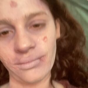 Lara Tremouroux Instagram - Ainda não tinha postado foto/vídeo caracterizada de ~morta rs por motivos de spoiler, masss é no primeiro episódio ;) vai achando que “Últimas Férias” é só jovem bebendo y dançando y se pegando. É também kkkk mas o mistério da morte da Malu segue até o último episódio ❤️ assiste lá!, só no @starplusbr. Caracterização gênia de @madefreitas, direção do meu parceiríssimo @danidixolieff