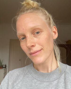 Laura Birn Instagram - Mulla on super kuiva iho joka menee huonompaan kuntoon helposti etenkin talvella ja kuvauksissa missä koko ajan lisätään meikkiä, poistetaan meikkiä, vaihdetaan meikki, on hiki, silikonia naamassa, pölyinen setti, savuinen setti, outo kokonaamakypärä etc. ja oon stressannut aina ennen kuvausjaksoja miten iho kestää tällä kertaa.
Viime kesänä löysin ystävän suosituksesta Skinmediiin jossa ihana Anne teki mulle ihoanalyysin, joka kertoi samaa ihon kuivuudesta ja huokosten tukkeutuneisuudesta, mutta totes samalla että asian ei todellakaan tarvitse olla niin.
Anne on tehnyt mulle vuoden aikana mm. mesoterapiaa, led-hoitoja ja mielettömän aquagold fine touch-hoidon✨  ja neuvoi mulle täsmätuotteet mun ihotyypin ja sen tarpeiden mukaan. Nyt takana on talvi ja pitkät kuvaukset, mutta iho tuntuu ihmeellisen pehmeältä ja kosteutetulta ja näyttää levänneeltä, ihan kuin olis nukkunut 5kk putkeen 🦦 ja tän vuoden aikana töissä kolme eri maskeeraajaa on kiinnittänyt huomiota mun muuttuneeseen ihoon! On ihanaa mennä töihin kun ei tarvitse stressata tästä.
 @skinmed_fi ja @skinbyanne 💎💎💎