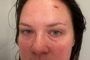 Lauren Pritchard-Cobb Instagram - Here’s the thing about the month of February… it has meant I’ve spent more time at the doctors office than I have since my days of getting diagnosed with epilepsy. And basically, what I’ve had to be reminded of is that I need to pay attention to my health more closely. I’ve been having heart tests run to find out what is causing me pain in my chest. We’re getting to the bottom of it and hope to know more after my next appointment in a weeks time. Then I went and got my head dented which was just one of those extra things no one ever needs but I will heal! In the meantime I have had the opportunity to emcee and sing for a handful of meaningful events in my hometown including the Blue Suede Dinner and Auction this past Saturday night where we raised $435,000 to put towards helping children in west Tennessee heal and repair their lives after they’ve been through abuse. Today we celebrate my father’s 60th in @waltdisneyworld per his request! I’m grateful for my husband & family for helping me take better care of myself, for my beautiful child who makes every day brighter and I hope this extra time having to examine my health means I will live to see 60 one day, too! Here’s some of the February highlights. 🫶🏻🥳❤️‍🩹☀️🐰