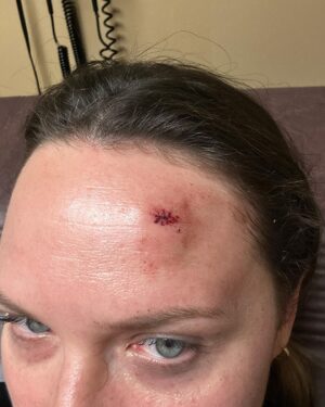 Lauren Pritchard-Cobb Instagram - Battle scars are necessary. Be back up soon. 🫶🏻