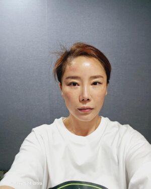 Lee Chae-dam Instagram - " 덕소엔비의원 " 에서 3차!!!!! 피코토닉하고 기미,잡티,흉터 실펌x를 3차 하고 왔어요 한달만에~ 너무너무 깨끗해졌쥬~^^