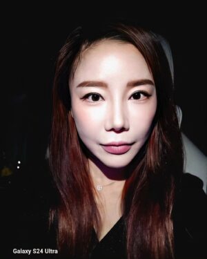Lee Chae-dam Instagram - " 덕소엔비의원 " 에서 3차!!!!! 피코토닉하고 기미,잡티,흉터 실펌x를 3차 하고 왔어요 한달만에~ 너무너무 깨끗해졌쥬~^^
