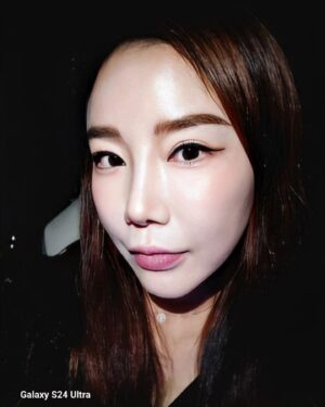 Lee Chae-dam Instagram - " 덕소엔비의원 " 에서 3차!!!!! 피코토닉하고 기미,잡티,흉터 실펌x를 3차 하고 왔어요 한달만에~ 너무너무 깨끗해졌쥬~^^