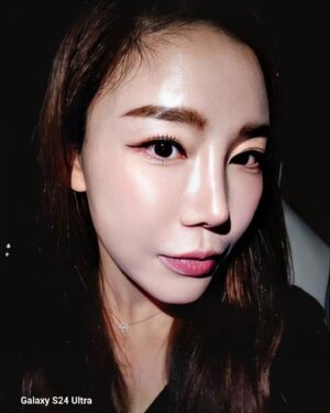 Lee Chae-dam Instagram - " 덕소엔비의원 " 에서 3차!!!!! 피코토닉하고 기미,잡티,흉터 실펌x를 3차 하고 왔어요 한달만에~ 너무너무 깨끗해졌쥬~^^