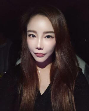 Lee Chae-dam Instagram - @mjskinclinic

V&M 에서 울쎄라 한지 벌써 7개월이 되었는데, 어머머 아직까지 탄력이!!!!!
초~대박!!!!!!!

울쎄라가 생각보다 많이 아프진 않았지만, 피부가 얼얼하더라구용 ㅜㅜ

이뽀지려면 참아야죠^^

너무 친절하시고, 주차도 편해서 너무 좋았다능~^^

#울쎄라 #써마지 #울써마지 #커스텀울쎄라 #커스텀써마지 #브이앤엠제이피부과성형외과 #브이앤엠제이피부과 #엠제이피부과#브이앤엠제이