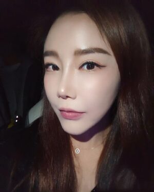 Lee Chae-dam Instagram - @mjskinclinic

V&M 에서 울쎄라 한지 벌써 7개월이 되었는데, 어머머 아직까지 탄력이!!!!!
초~대박!!!!!!!

울쎄라가 생각보다 많이 아프진 않았지만, 피부가 얼얼하더라구용 ㅜㅜ

이뽀지려면 참아야죠^^

너무 친절하시고, 주차도 편해서 너무 좋았다능~^^

#울쎄라 #써마지 #울써마지 #커스텀울쎄라 #커스텀써마지 #브이앤엠제이피부과성형외과 #브이앤엠제이피부과 #엠제이피부과#브이앤엠제이
