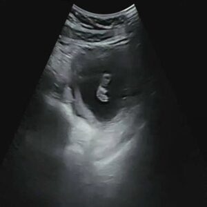 Lee Ji-hoon Instagram - 두번째 기적

아야가 내게 와준 첫번째 기적
그 아야가 두번째 기적을 품고 
부모가 되어 갈 준빌 하네요
정말 감사하단 말밖엔 더 할 말이 없네요
감사합니다 감사합니다 주님💜

우리 젤리
세상에 빛과 소금의 소망 품고 건강하게
태어나길 기도합니다
아야에게도 건강을 주시고 평안을 주세요🙏

이런 기적같은 일들을
소소하게 유투브 지아라이프 채널을 통해
나누려 합니다
여러분 많은 관심과 사랑 부탁드려요💜