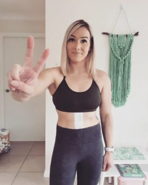 Leigh Holland-Keen Instagram - ⚠️SENSITIVE CONTENT WARNING - PLEASE DO NOT SWIPE IF YOU DO NOT WANT TO SEE SURGERY PICTURES DURING OPERATION ⚠️ 

The peritonectomy team at St George Hospital did an amazing job of removing this mass, it was entwined with my bowel and attached to my kidney and abdominal wall. So thankful for Professor Morris and all his hard working team ❤️. 

It's amazing what medical professionals can do and it's amazing what the human body can endure. 

EDIT ⚠️ - Slide 1 & 2 show the tissue wrapping around the bowel and kidney. The last slide shows the mass on the right side - that big 1kg of cancer is NOT supposed to be there. 
#surgery #bowelresection #postoprecovery #peritonectomy #feelinggrateful #strongwoman #humanbody #medical #sensitivecontent  #rebuildbyleigh #resilience