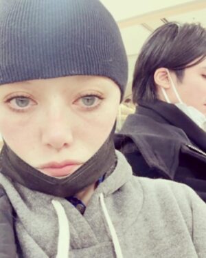 Léona Hirota Instagram - 本当はね
今日の朝8時から手術のはずだったの
変形性股関節症で
去年の暮れには部分的に壊死しちゃっていて😅こりゃ足掻いててもダメだなって😂
Amazonで前開きのパジャマも買って準備してたんだけど…先月の20日くらいからヒロムくんが鼻水出てて鼻炎だって言ってたんだけど私にも移って、私だけ熱もどんどん上がって40°超えちゃって🥵病院行ったらインフルA型😱
なかなか治らなくて喘息も酷くて
ドクターから…手術は仕切り直しと…😭
まぁ正直、怖かったから🥹助かったのかな…😂
来月になるのかな…
人工股関節になってリハビリして痛くなくなったらダンス動画あげるね😅

#今年の夏には映画の撮影が再開できますように
#能登半島地震で被災された方々
に心よりお見舞い申し上げます
