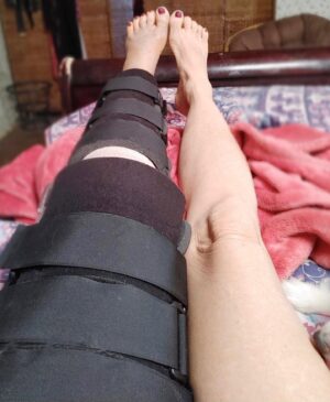 Linnea Quigley Instagram - Current Situation. Good News, the surgery went well. The bad news is that for two days after it felt like someone was sawing at my leg. It’s better today and the flowers and well wishes cheered me up a lot!!!!!! Thank you all! Now I just have to heal. Any names of movies or tv shows will be appreciated