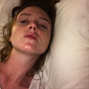Lorraine Nicholson Instagram - a sunburn is the universe saying “go back inside”