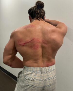Manuel Alfonso Andrade Oropeza Instagram - Smile at the pain!!