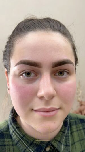 Martina Urban Instagram - You will not believe your eyes when you see this result 🤯😍

What a pleasure it was to perform this ombree eyebrows transformation on this beautiful model ✨. This was achieved on @art_place_magdalena_telesinska Ombreé Brows masterclass last week and I really love it! What do you think?💘

#martinaliskova #pmuexpert #eyebrowsonfleek #shadoweyebrows #perfecteyebrows #ombreebrows #permanenteyebrows #beautytricks #beautytreatments #pmu #permamentmakeup #southyourkshire #uk