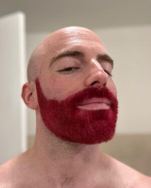 Matthew Santoro Instagram - FOR CHARITY! Recently I took part in the Light In The Fog Tournament to raise money and awareness for ALS (specifically for Puppers, a member of the Dead by Daylight community). And together we raised over $100,000! I auctioned off the colour of my beard and the winner got to choose the colour. And the pick was hot pink! Honestly it’s kind of a vibe 😆 Swipe to see the process. The last photo was my first dying attempt but nobody told me you’re supposed to bleach your hair first…it was my first time give me a break 🤪 #ALS #Charity #Love
