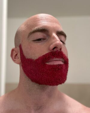 Matthew Santoro Instagram - FOR CHARITY! Recently I took part in the Light In The Fog Tournament to raise money and awareness for ALS (specifically for Puppers, a member of the Dead by Daylight community). And together we raised over $100,000! I auctioned off the colour of my beard and the winner got to choose the colour. And the pick was hot pink! Honestly it’s kind of a vibe 😆 Swipe to see the process. The last photo was my first dying attempt but nobody told me you’re supposed to bleach your hair first…it was my first time give me a break 🤪 #ALS #Charity #Love
