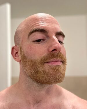 Matthew Santoro Instagram - FOR CHARITY! Recently I took part in the Light In The Fog Tournament to raise money and awareness for ALS (specifically for Puppers, a member of the Dead by Daylight community). And together we raised over $100,000! I auctioned off the colour of my beard and the winner got to choose the colour. And the pick was hot pink! Honestly it’s kind of a vibe 😆 Swipe to see the process. The last photo was my first dying attempt but nobody told me you’re supposed to bleach your hair first…it was my first time give me a break 🤪 #ALS #Charity #Love