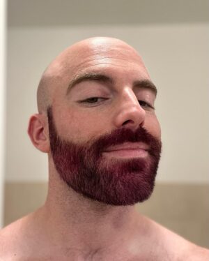 Matthew Santoro Instagram - FOR CHARITY! Recently I took part in the Light In The Fog Tournament to raise money and awareness for ALS (specifically for Puppers, a member of the Dead by Daylight community). And together we raised over $100,000! I auctioned off the colour of my beard and the winner got to choose the colour. And the pick was hot pink! Honestly it’s kind of a vibe 😆 Swipe to see the process. The last photo was my first dying attempt but nobody told me you’re supposed to bleach your hair first…it was my first time give me a break 🤪 #ALS #Charity #Love