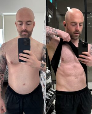 Matthew Santoro Instagram - I've never posted a shirtless picture before, so believe me when I say it took a lot for me to do this. 69 days ago today I decided to get my health back on track. I struggled for 3 years with an unhealthy diet and overeating as a result of the trauma I dealt with during the pandemic years. I comforted myself with food instead of facing my demons. The picture on the left was taken on Feb 14th 2024 (Valentines day) when I was depressed and tired of life. After flip flopping for 3 years I decided to finally and permanently make a lifestyle change that would get me in the best shape of my life. Every day my schedule looks like this: wake up early and run 10K fasted (I worked up to this from 3-5K). Intermittent fast 16 hours a day from 9PM to 1PM. Stay on a calorie deficit. Drink a gallon (4L) of water a day. Hit the gym and lift weights at night. Get plenty of sleep. And today I finally started seeing significant results. So, why am I posting this even though I feel vulnerable? Because I know I'm not alone and there are a lot of people who are still handling trauma from the pandemic and maybe even from before. Please know you CAN do it. You CAN pull yourself out of hell, and you CAN better your life. I had several days - even weeks - of falling throughout this process where I ate junk, sometimes multiple days in a row. But I didn't give up. CONSISTENCY. Just SHOW UP EVEN WHEN YOU DONT WANT TO. That's the key. And one day you'll wake up and say "wow. I did it". Make today your day one.
PS: I'm not done! This is just 69 days into a whole new life. I'll be 39 this year (in 3 months), and I intend on having a 6 pack for the first time in my life by that day!