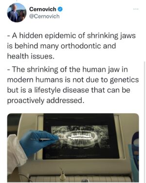 Mike Cernovich Instagram - - A hidden epidemic of shrinking jaws is behind many orthodontic and health issues. 

- The shrinking of the human jaw in modern humans is not due to genetics but is a lifestyle disease that can be proactively addressed. 

https://news.stanford.edu/2020/07/21/toll-shrinking-jaws-human-health/