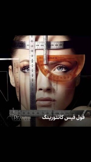 Mohammad Khademi Instagram - .
حتما میدانید که با افزایش سن در صد کلاژن و چربیهای منطقه‌ای صورت
شروع به کاهش و ریزش می‌کنند
و این مسئله باعث حرکت رو به پایین کل کادر صورت می‌شود و فرم صورت را در این حالت به صورت افتاده و خسته نشان می‌دهد
.
در تزریقات کانتورینگ با محاسبه هارمونی،
برای سنین جوانی، طراحی دقیقِ تزریق انجام میشود
.
🌐نقاط کلیدی در تزریقات کانتورینگ فول فیس
شامل «اصلاح گونه‌ها »و ایجاد فرم لیفتینگ در گونه‌ها
و تزریق آن به هدف جبران چربی‌های از دست رفته پوست،
ورپوزیشن انها همراه با «تزریق چانه »و در مواردی تزریق «زاویه فک »است
.
✅👌لازم به ذکر است در خیلی از افراد با افزایش سن
و یا به صورت ژنتیکی و حتی بر اثر کاهش وزن
چربی ناحیه شقیقه از بین میرود!
که اصلاح آن برای تناسب کل قاب صورت لازم است
.
🌱ایجاد زیبایی در نقاط شقیقه، گونه و چانه
و در موارد زیادی زاویه فک باعث می‌شود
فرم صورت به بهترین حالت ممکن برسد
.
👌مهم‌ترین نکته در تزریق کانتورینگ فول‌ فیس این است که
عدم استفاده از حجم‌های غیر معمول فیلر (over correction syndrom) و عدم تناسب برای خارج شدن فرم صورت از حالت طبیعی، کاملا به هنر پزشک و قدرت تکنیکالی و زیبایی شناسی او بستگی دارد
زیرا اصلاحات بیش از حد باعث نامتناسب شدن فرم طبیعی صورت می‌شود
.
😍شاد و سلامت باشید
دکتر محمد خادمی
.
📍تهران، زعفرانیه، خیابان مقدس اردبیلی، روبروی مرکز تجاری پالادیوم، پلاک ۸۱، طبقه ۴
☎️021-22175864 - 0910-0036360
.
#زیبایی #کانتورینگ_صورت #کانتورینگ #فیلر #ژل
#پزشک_زیبایی #جوانسازی #میدفیس #تزریق_فیلر