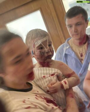Mstyslav Chernov Instagram - Russian rockets hit Ukrainian cities again. “Ohmatdyt” children's hospital, residential buildings, shops, streets… Dozens of injured and dead.

Imagine this happening to your your city and your nation. Every day. What would you feel?

Photo: Astra, Ukrianian Pravda