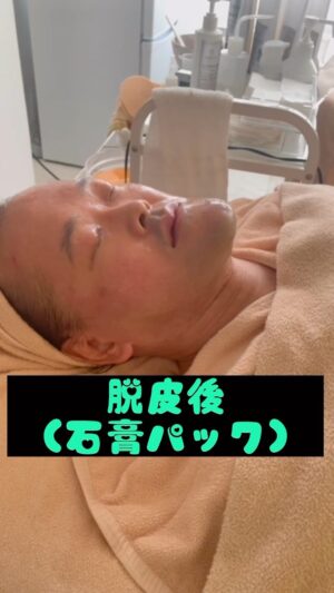 Naoki Inada Instagram - 続き

#稲脱皮