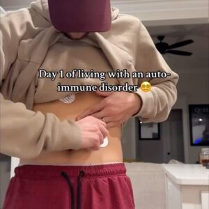 Nathan Triska Instagram - I suppose it’s not technically day one since I’ve been dealing with this for so long but at least I finally got diagnosed😬🙏 I will probably be doing these vlogs from time to time to have a sense of normalcy and to track everything that’s going on😊🫶🏼❤️ #vlog #autoimmune