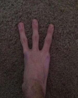 Nathan Triska Instagram - Just gave birth! He’s a little hairy, idk why