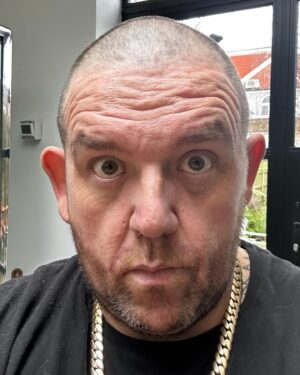 Nick Frost Instagram - Wonky old ear on this Prick.
#wonkyoldearonthisprick