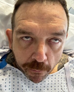 Nick Frost Instagram - I’m fine! I’m awake! I have a new knee. I’m in agony but I’m so happy. I’ve suffered with arthritis for years and now that is gone!!! Can’t wait to start my recovery! Send kisses. 😍😍😍(and Morphine!)