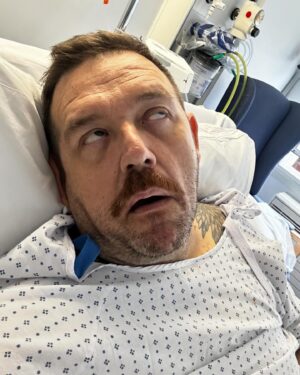 Nick Frost Instagram - I’m fine! I’m awake! I have a new knee. I’m in agony but I’m so happy. I’ve suffered with arthritis for years and now that is gone!!! Can’t wait to start my recovery! Send kisses. 😍😍😍(and Morphine!)
