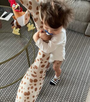 Nira Juanco Instagram - Hoy es el día Mundial de las enfermedades raras. 
Hay unas 7.00 diagnosticadas que afectan al 7% de la población mundial.
Mi hijo Daniel tiene una de ellas, Nevus Melanocítico Congénito Gigante. Es una malformación en la piel que no se sabe por qué sucede. A la hora de repartirse la pigmentación de la piel en el primer trimestre de embarazo, hay una anomalía que hace que salgan estas manchitas siendo alguna de ellas “gigante”.
Daniel está bien. Afortunadamente, en su caso es un tema estético y de revisión constante toda su vida y con mucho cuidado con el sol.
Ayudemos a la investigación y difusión de estas enfermedades y normalicemos que no todos somos iguales.
#bareyourbirthmark #enfermedadesraras @fernandomeco 
@monographica.brand
