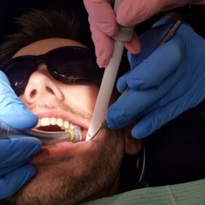 Parry Glasspool Instagram - Well, we've done it! We've reached the retainers! 21 sets of #Invisalign and exactly where we wanted to be. Like clockwork! Or like Teethwork, should I say....huh? Sorry? ...Ah Okay, I'm being told that pun doesn't work, and that infact it isn't even a pun. It's just nothing. Ay? Get back to the point? Ah, right, yes!

So massive thanks to the team at @thedentalteammanchester @thedentalteamgroup and Mustafa, who got in there and got the job done like the absolute pro he is! I highly recommend it guys, if you're already thinking about getting it done, make the step and do it 👊🏼👊🏼👊🏼👏🏼
