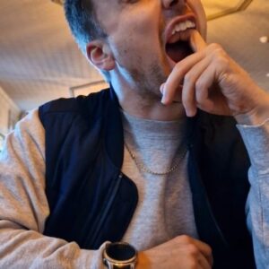 Parry Glasspool Instagram - Never let your journey to straight teeth get in the way of romance...

Disclaimer! They're not this difficult to take out 😂😂

#invisalign #funny