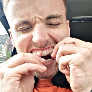 Parry Glasspool Instagram - Invialign update! Officially on set number 21. Last set for the original deadline. I'm really happy with how my teeth are/have turned out. Didn't realise they were wonky, to be honest, but this obviously proves they were....i feel a fool. 
Always recommend invisalign if you're looking to get those teeth moving, if you can afford it, I say go for it!
@thedentalteammanchester #invisalign