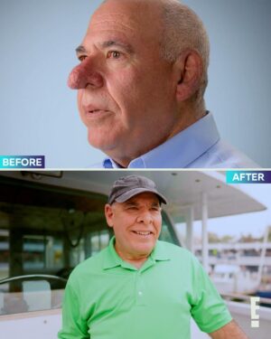 Paul Nassif Instagram - Looking great and feeling even better, that’s what this season has been all about. 🥰 There’s still more remarkable results to come on the season finale of #Botched, Thursday 10/9c on E!