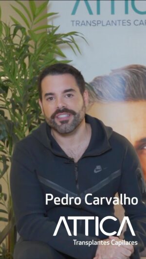 Pedro Carvalho Instagram - Com o passar dos anos, a densidade capilar da maioria dos Homens vai diminuindo. Eu sempre fui um sortudo nesse quesito, porque tenho muito cabelo, mas há uns anos atrás comecei a ter uma pequena alopecia (perda de cabelo em forma circular somente numa determinada parte do couro cabeludo) e que me incomodava, até pelo meu ofício, então resolvi vir até à Clínica @attica.pt em Lisboa. Têm os melhores profissionais e são super atenciosos. Zero inchaço, sem dores e daqui por uns dias, poucos, até por ter sido uma área muito pequena que pretendo tratar, já poderei fazer desporto🙌🏻