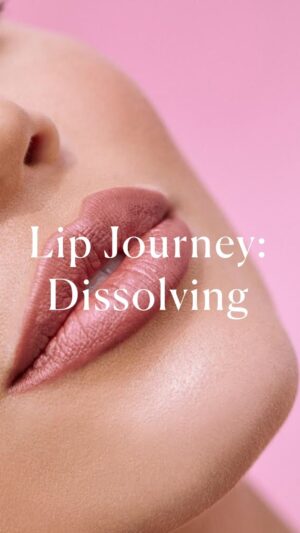 Rachel Brann Instagram - Welcome to my #LipJourney no gatekeeping here on all the cosmetic procedures I get! Ask me your questions. Laugh at the ridiculous size of my lips. Tell me about your journeys! 
And I’ll share as much as you guys want to know about my journey. I’m so grateful for @jordonio.np for taking on this task. I honestly thought my lips looked great. But now that the filler has been dissolved for a while, I can see how much my natural shape was warped. 

in this session we used 4 syringes of Hylenex. She tried to warn me that it was going to be very swollen, but I had no idea of what was to come. 😂😂 a lot of y’all thought it was a filter. No that was my lips in that last video. #lipfiller #cosmetics