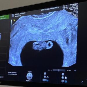 Rafael Cavada Instagram - En marzo, con @fiorella_choca nos enteramos que vamos a ser padres por tercera vez. Quería compartir esta felicidad enorme con todos ustedes. 🤰