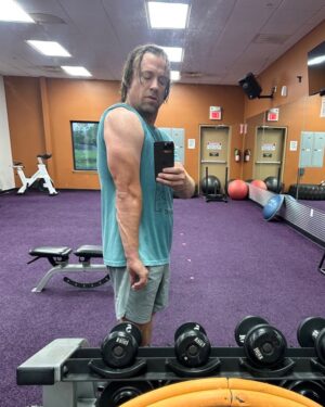 Reed Timmer Instagram - Check out this weird bump on my arm from storm chasing so much