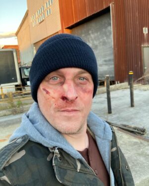 Robin Lord Taylor Instagram - You should see the other guy. (Jk I smashed my own face on a sink to evade facial recognition software lol) All new @nbclawandorder #OrganizedCrime tonight at 10 EST!