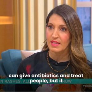 Rosena Allin-Khan Instagram - As a doctor, I welcome every opportunity to share any medical advice that may help people, whether that’s in A&E or reaching a wider audience. Today, I was thrilled to be on @thismorning once again to talk about how to spot signs that a rash may be a concern.

In this snippet, I outline how rashes can be difficult to see on darker skin tones, often leading to delayed treatment and poorer outcomes. When looking for signs of scarlet fever, the rash can be raised and feel rough like sandpaper. Your GP should be the first port of call if you notice these symptoms and, if it gets worse, you should always go to A&E.

Thanks so much to @dermotoleary and @alisonhammond55 for having me on.