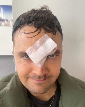 Ruben Søltoft Instagram - altid drømt om et frækt ar