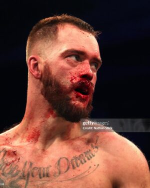 Ryan Taylor Instagram - The journey is what we live for. The challenge is what keeps us alive. ANNOUNCEMENT COMING!!!

This popped up on my memories today and it made me realise so many things. But mainly of all. Huge respect to JJ for continuing to push when everyone goes against you. We’re tested most when we’re down. Getting to the top is easy. Staying there is the hard part. @ksi nothing but love my G. 🫡🤍 #ksi #bmx #collectivebikes #misfitsboxing #prime #london #headbuttking