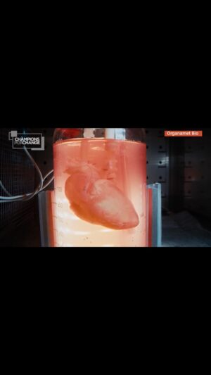 Sanjay Gupta Instagram - In 2021 < 4,000 people had heart transplants and nearly as many are still waiting. Doris Taylor thinks she can eliminate the wait and do this impossible: create a personalized heart for anyone. It starts with a ghost heart. Watch @cnn ‘s Champions for Change Saturday at 8pET